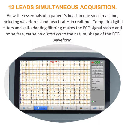 Biocare iE300 12-lead ECG Machine