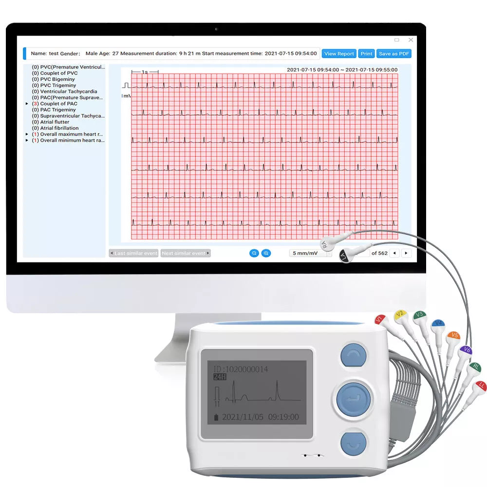 Wellue 12-Lead ECG Holter Monitor