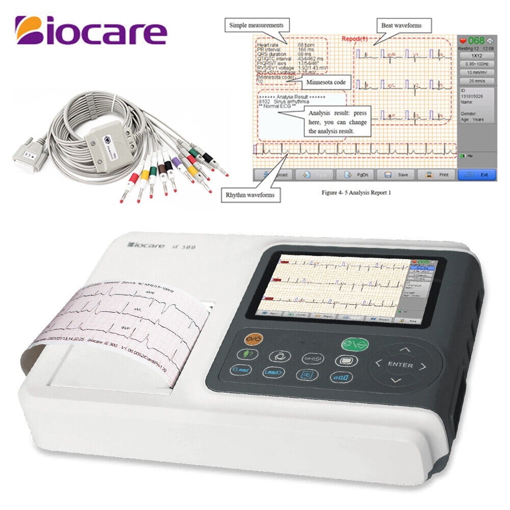 Checkme ECG Machine 3 Channel 12 Lead Portable Heart Diagnostic Auto Analysis EKG Printer, iE300