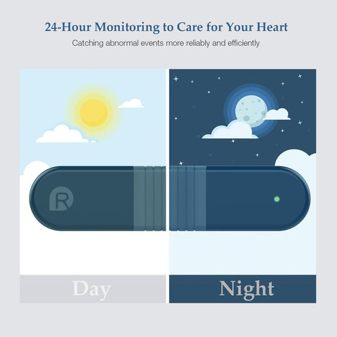 Checkme ER1 24 Hours AI ECG Holter