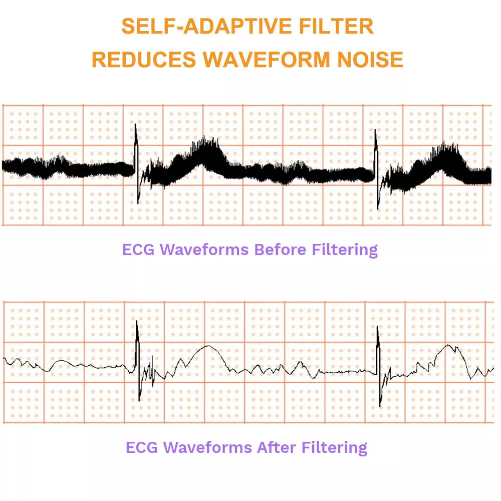 Wellue ER1-LW 24 Stunden Langzeit EKG Gerät für Zuhause, AI-EKG Analyse Wellue ER1-LW 24 Stunden Langzeit EKG Gerät für Zuhause, AI-EKG Analyse