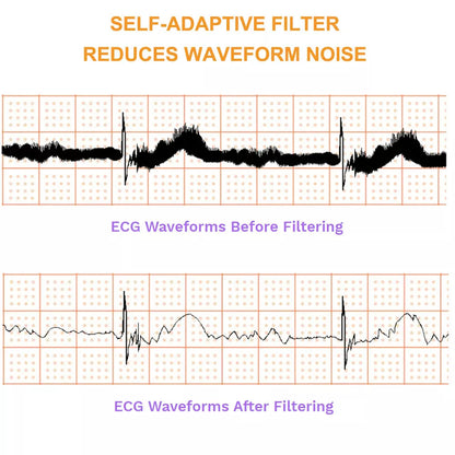 Biocare iE300 12-lead ECG Machine