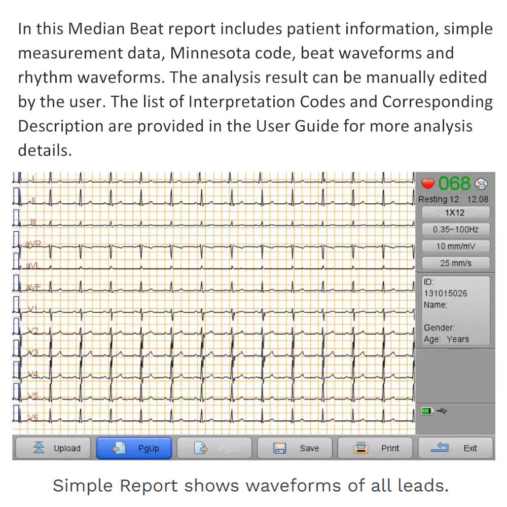 Biocare iE300 12-lead ECG Machine