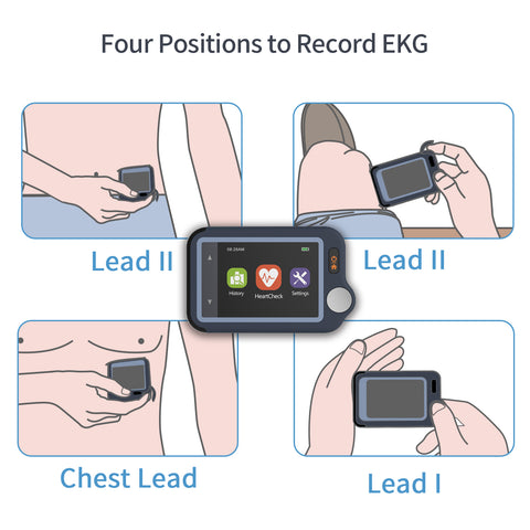 Checkme Pulsebit EX EKG-Monitor