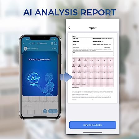 Checkme BP2 Connect Blood Pressure Monitor