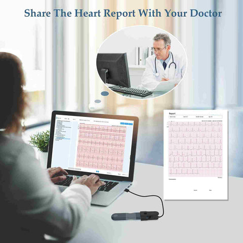 Checkme ER1 24 Stunden AI EKG Holter