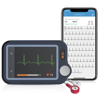 Checkme Monitor ECG Portatile Indossabile, Registrazione Elettrocardiografo  a Lu