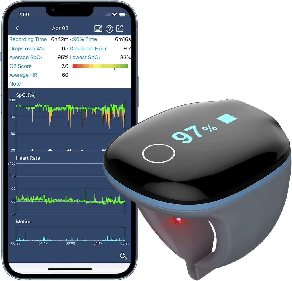 O2Ring Wearable Pulse Oximeter with Alarm – Checkme
